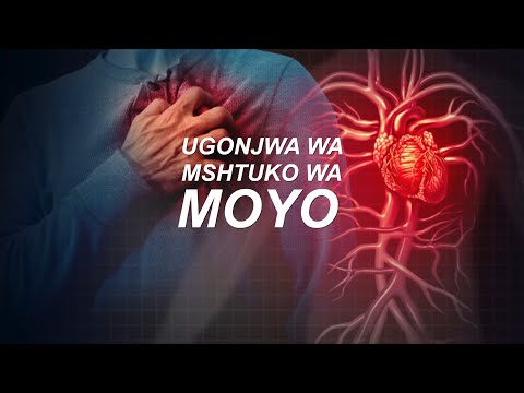 Video: Sababu Za Ukuzaji Wa Mshtuko Wa Hofu