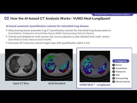 AI based Chest CT Quanrification Solution