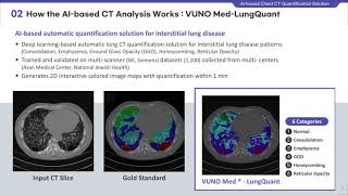 AI based Chest CT Quanrification Solution