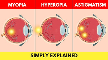 Refractive Errors Explained (myopia, hyperopia, astigmatism)