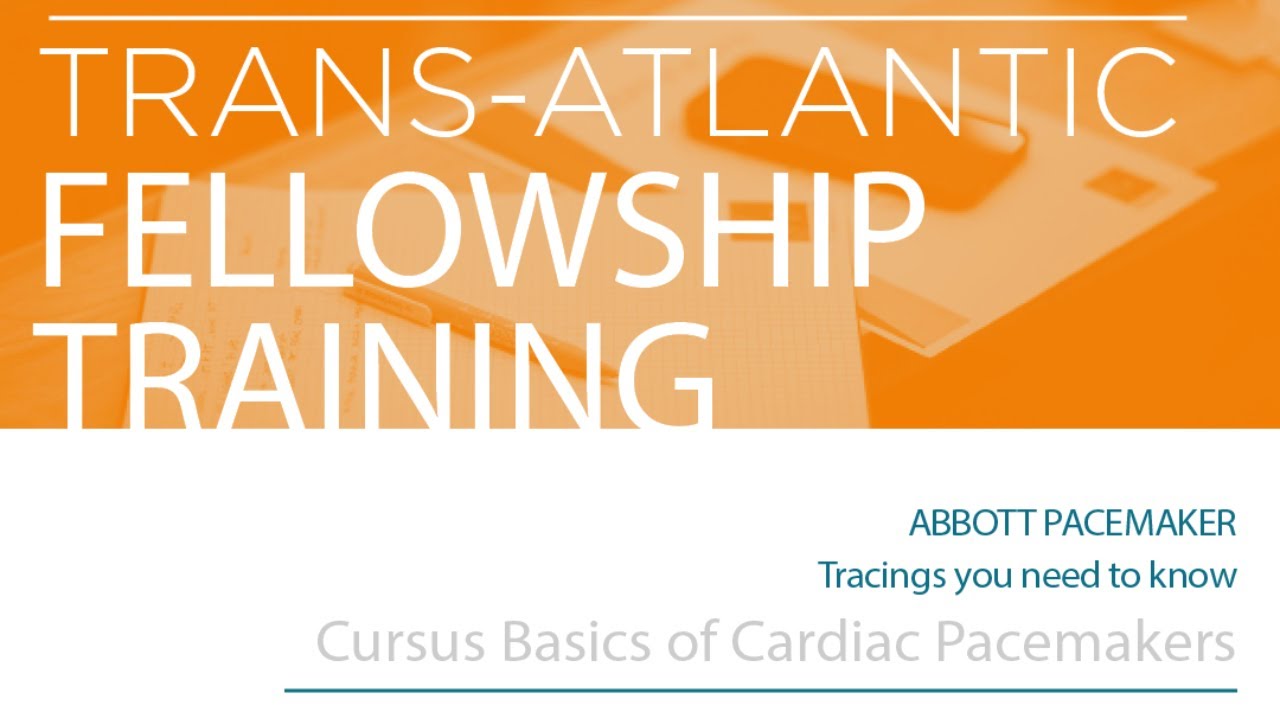 Trans-Atlantic Fellowship Training : 5- Abbott Pacemaker -Tracings you ...