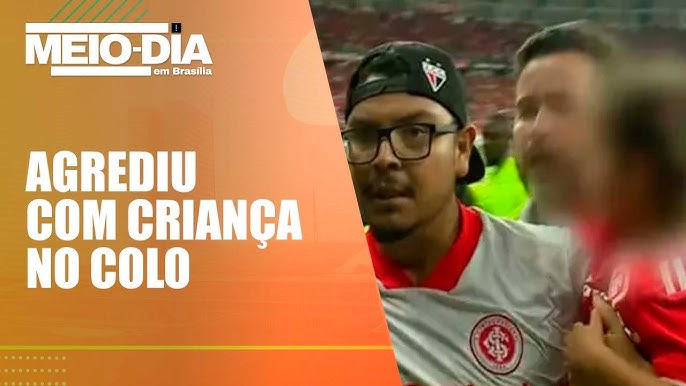 FOTO: Jogador do Caxias fica com nariz 'deformado' após confusão em jogo  contra o Inter