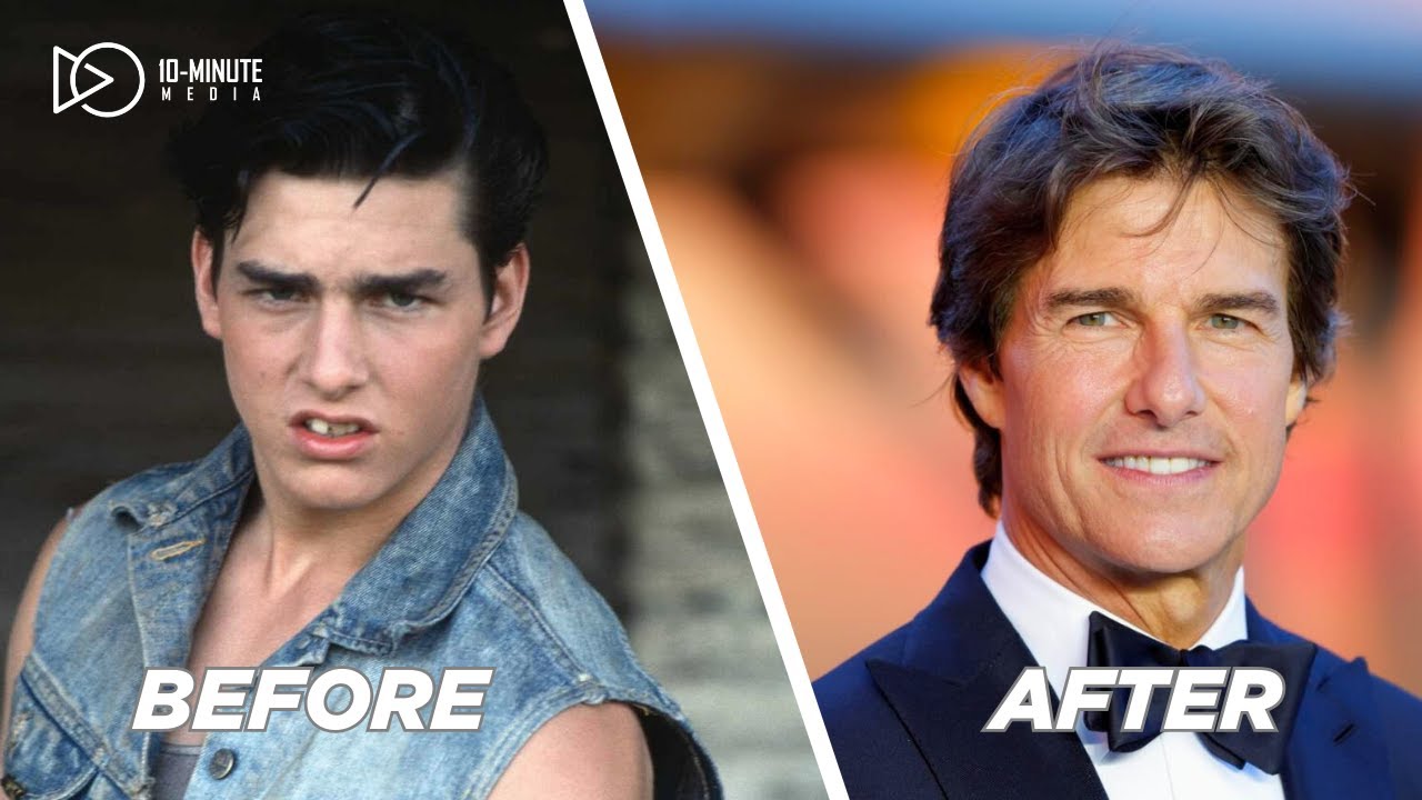 BOLLYWOOD’S PLASTIC SURGERY SECRETS EXPOSED! (Before & After Will SHOCK You!)