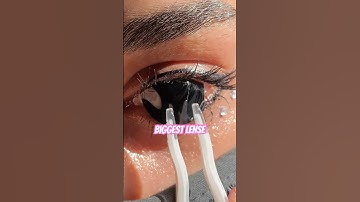 Omg biggest contact lenses removing 💕 #shorts #short #shortsvideo