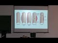 Lecture On Aneurysms vs. Vasodilation & Types of Heart Failure | Pathology | MBBS