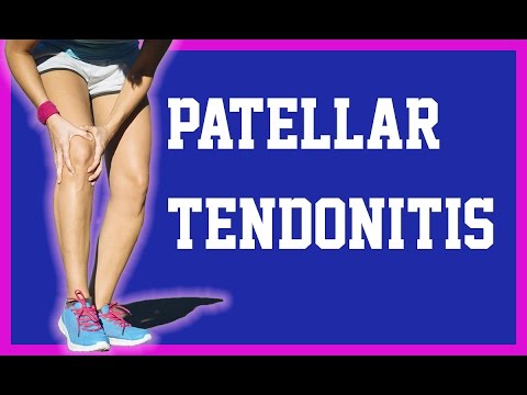 patellar-tendonitis-dry-needling---patellar-tendonitis---neobracex