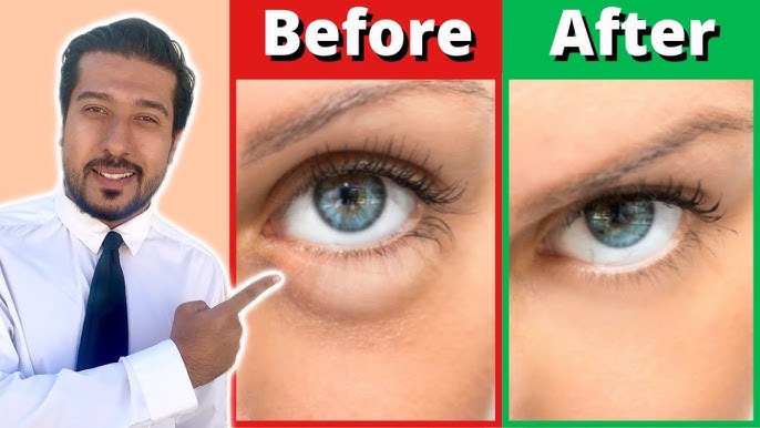 Stryx  How to Get Rid of Puffy Eyes & Why You Wake Up With Them