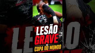 🚨 LESÃO GRAVE NA COPA! Entrada Chocante Deixa Jogador com Perna Quebrada