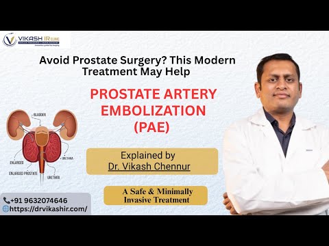 Prostate Artery Embolization By Dr  Vikash Chennur