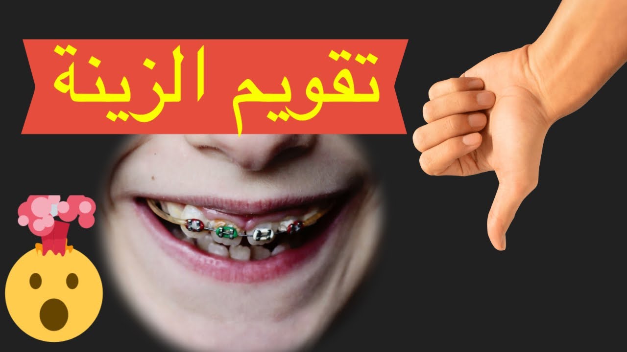 تقويم زينه للبيع تقويم اسنان شد و زينه للبيع السلام عليكم