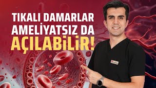 Bypass Ameli̇yatlari Tari̇h Mi̇ Oluyor?