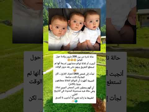 أم تنجب 3 توائم متطابقين تمام ا والعلم يحتار في تفسيرها