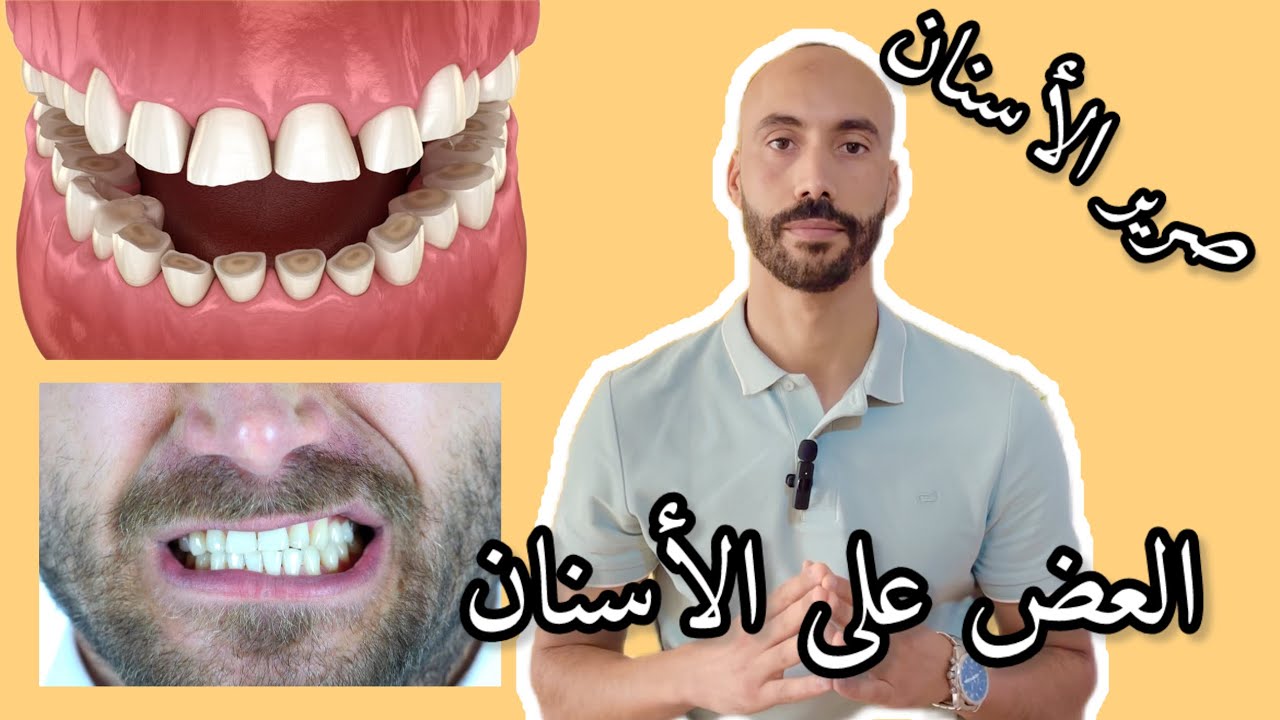 العض على الأسنان (الغزان ديال السنان) , صرير الأسنان😬 | الأسباب والأعراض والحلول؟