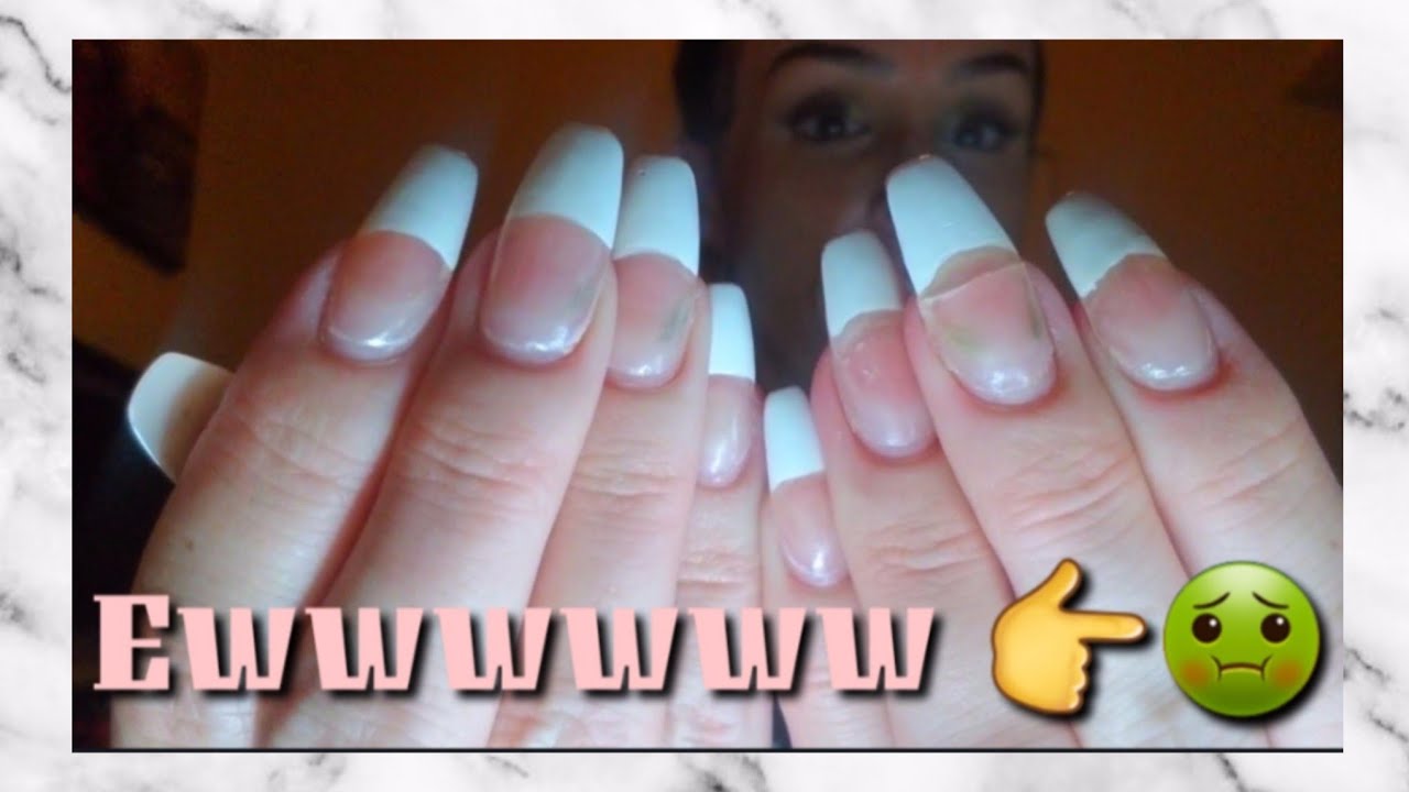 How to easily remove artificial nails | NAIL FUNGUS!! - YouTube