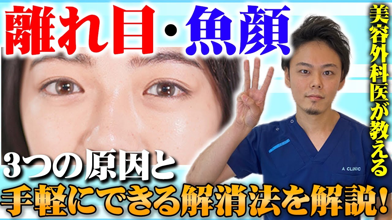【離れ目解消】目と目を近づける方法を医師が教えます！ - YouTube