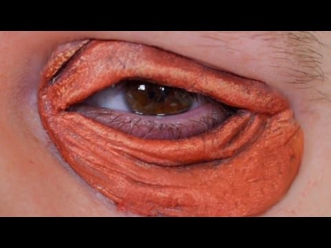 Video: I Stället För ögon, Slitsar: Priluchny Dök Upp Offentligt Med Ett Svullet Ansikte