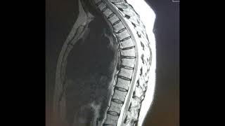 273 Hz : Spine Thoracic T5 (RIFE Healing Frequency)