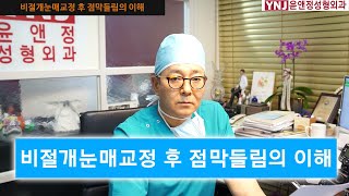 비절개눈매교정 후 점막들림의 이해