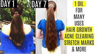 1 Magical Oil For Fast Hair Growth,Long lashes ,Acne Spots & Stretch marks | SUPERPRINCESSJO
