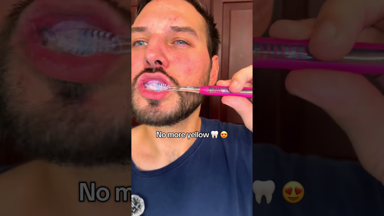 ✨Whiter teeth in just 7 days!✨ This Lysozyme Purple Whitening & Color Repair Toothpaste