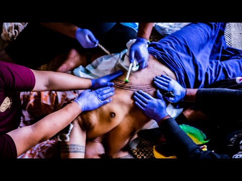 LAEI O SAMOA - SU'A LOTOMALIE SULUAPE TATAU