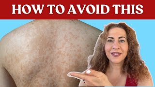 Is Fungus Taking Over Your Skin?