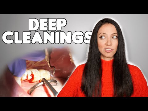 Video: Kdaj je potrebno globinsko čiščenje?