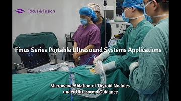 Microwave Ablation of Thyroid Nodules under Ultrasound Guidance