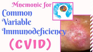 Common Variable Immunodeficiency Disorder (CVID) Mnemonic Common Variable Immunodeficiency Cvid Mnemonic For Usmle