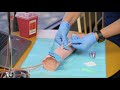 Anu 100 online medical assisting program  30 seconds