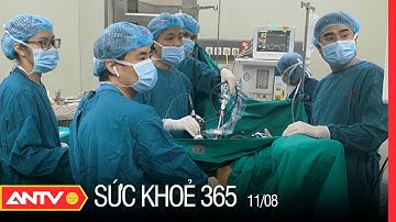 Nguyên Nhân Rụng Tóc Khi Điều Trị Ung Thư Bằng Hóa Trị | Sức khỏe 365 | ANTV