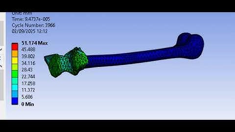 Bone Fracture Simulation Explicit Dynamics in Biomechanics  Fracture Mechanics biomedical Orthopedic