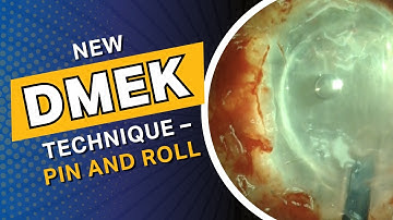 New DMEK technique – Pin and Roll