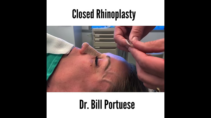 Closed Rhinoplasty Nose  Job Surgery Splint