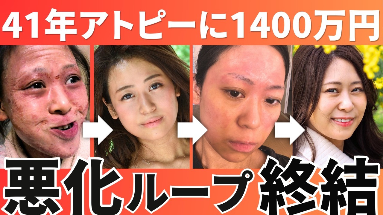 【アトピー核の知識って？】詳しくは概要欄↓