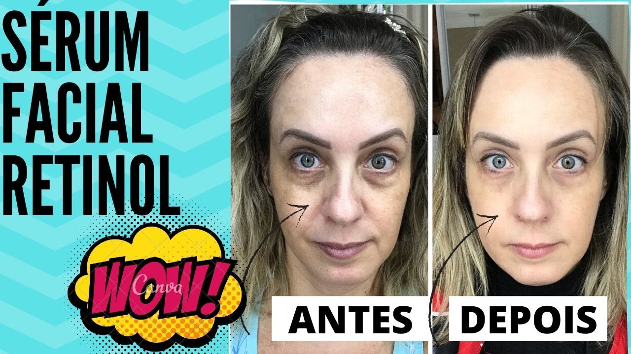 Rotina Leve + Retinol + Hialurônico3 Plus