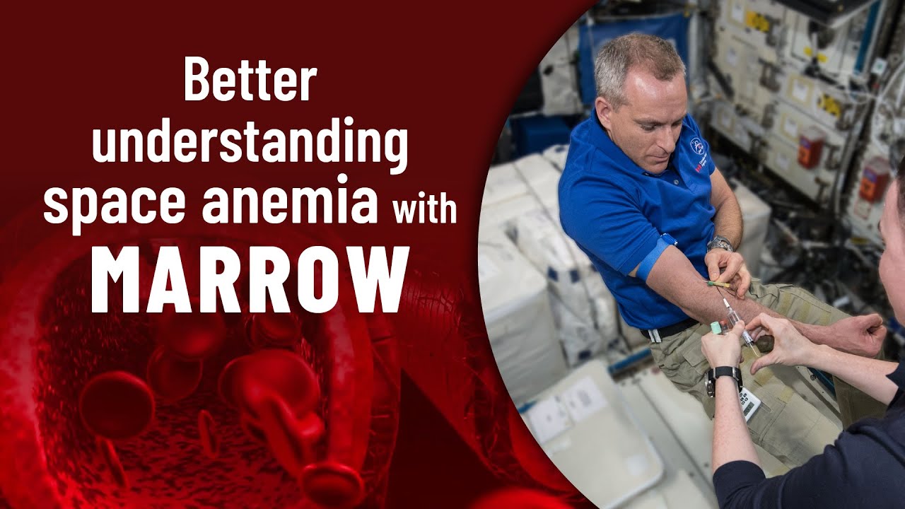 Better understanding space anemia with MARROW