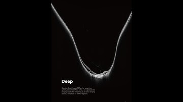 Image Gallery of DREAM OCT Intalight