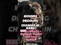 RABIES பாதிக்கப்பட்ட விலங்குகள் கடித்தால் என்ன செய்ய வேண்டும்?