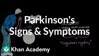 Movement signs and symptoms of Parkinson