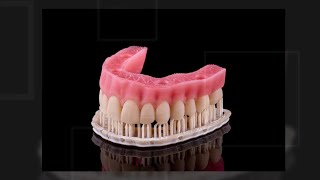 ADS Talks: Printed Tooth Structures