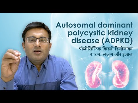 पॉलीसिस्टिक किडनी रोग: कारण, लक्षण, जांच, इलाज, जटिलताएं I ADPKD in hindi