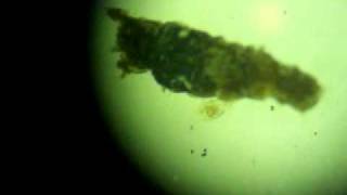 female of Acarus siro.flv
