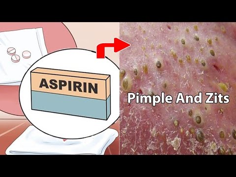 Video: Alternative uses of aspirin in the home