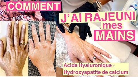 RAJEUNISSEMENT DE MES MAINS : LA TECHNIQUE MIRACLE !