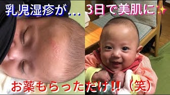 乳児湿疹 Youtube 乳児湿疹 Youtube