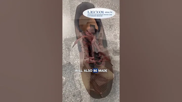 National Diabetes Awareness Month: Diabetic Shoes