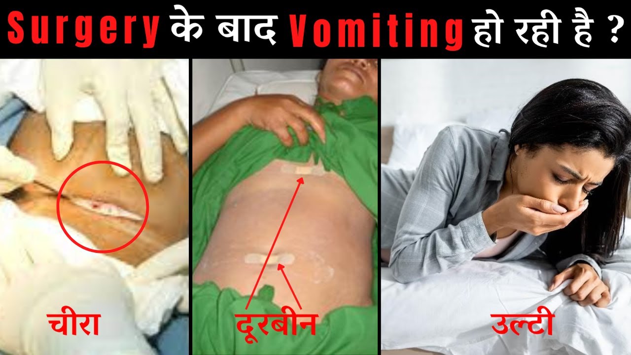 Vomiting after surgery ?  | ऑपरेशन के बाद उल्टियां होती है ?