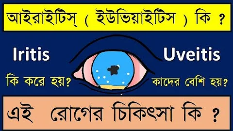 # anterioruveitis #iritis Iritis or Anterior uveit...