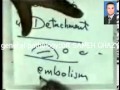 general pathology16 :embolism thrombus DR SAMEH GHAZY